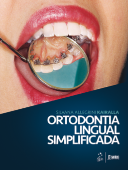 Ortodontia lingual simplificada