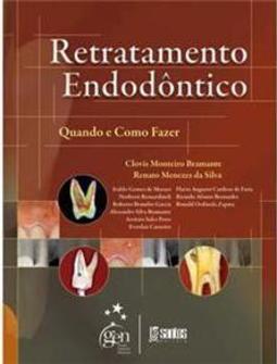 Retratamento Endodôntico