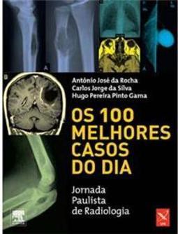 Os 100 Melhores Casos do Dia