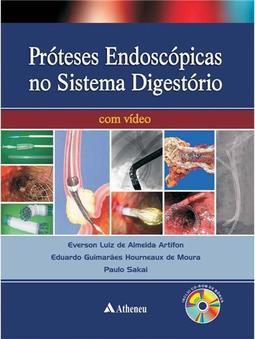 Próteses Endoscópicas do Sistema Digestório