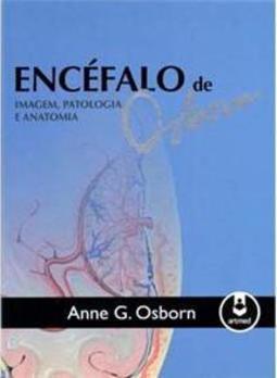 Encéfalo de Osborn
