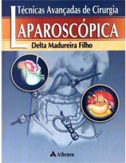 Técnicas avançadas de cirurgia laparoscópica