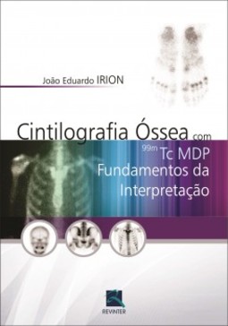 Cintilografia óssea com 99m Tc MDP: fundamentos da interpretação