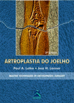 Artroplastia do joelho