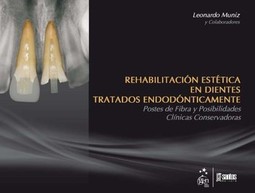 Rehabilitación estética en dientes tratados endodónticamente: postes de fibra y posibilidades clínicas conservadoras