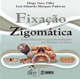 Fixação Zigomática