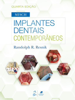 Misch - Implantes dentais contemporâneos