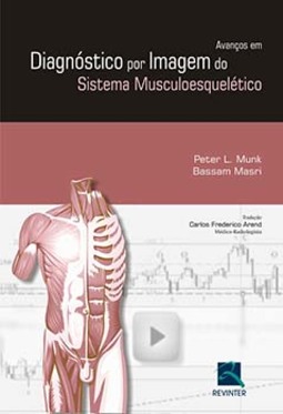 Avanços em diagnóstico por imagem do sistema musculoesquelético