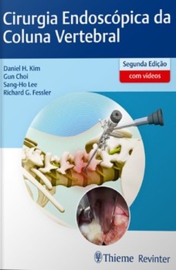 Cirurgia endoscópica da coluna vertebral