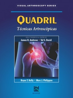 Quadril: técnicas artroscópicas