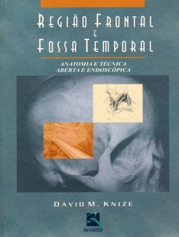 Região frontal e fossa temporal: anatomia e técnica aberta e endoscópica