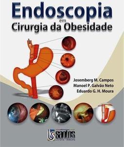 Endoscopia em Cirurgia da Obesidade