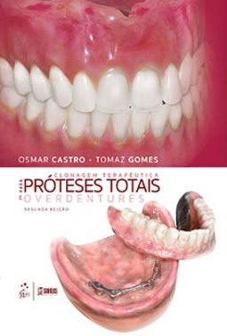 Clonagem terapêutica para próteses totais e overdentures