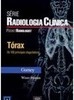 Tórax: os 100 Principais Diagnósticos