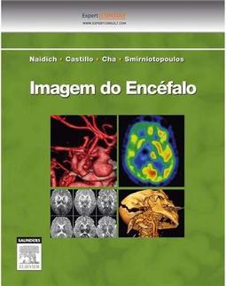 Imagem do encéfalo