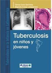 Tuberculosis en niños y jóvenes
