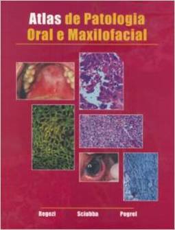 Atlas de Patologia Oral e Maxilofacial