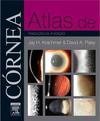 Atlas de córnea