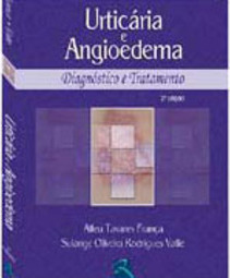 Urticária e Angioedema: Diagnóstico e Tratamento