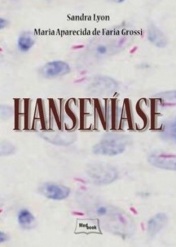 Hanseníase