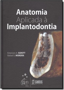 Anatomia Aplicada A Implantodontia
