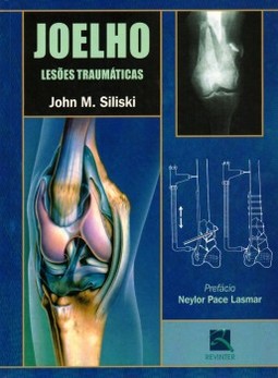 Joelho: lesões traumáticas