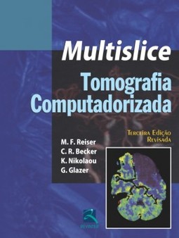 Multislice - Tomografia computadorizada
