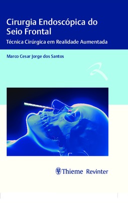 Cirurgia endoscópica do seio frontal