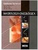 Mastologia Oncológica
