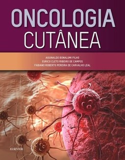 Oncologia cutânea