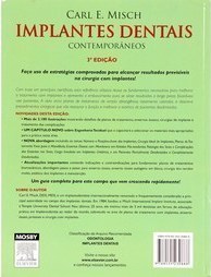 Implantes dentais contemporâneos