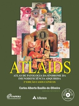 ATLAIDS: atlas de patologia da Síndrome da Imunodeficiência Adquirida