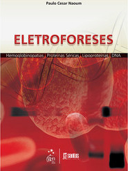 Eletroforeses
