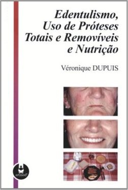 Edentulismo, Uso de Próteses Totais e Removíveis e Nutrição