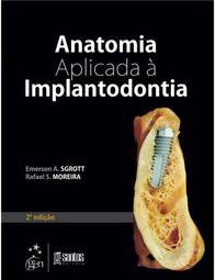 Anatomia aplicada à implantodontia