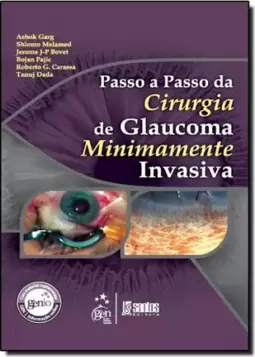 Passo A Passo Da Cirurgia De Glaucoma Minimamente Invasiva