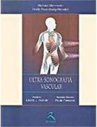 Ultra-Sonografia Vascular