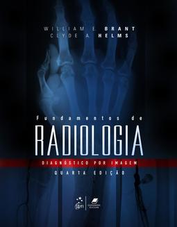 Fundamentos de Radiologia Diagnóstico por Imagem