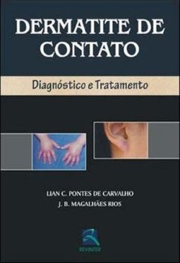 Dermatite de Contato: Diagnóstico e Tratamento