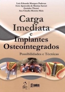 Carga imediata e implantes osteointegrados: Possibilidades e técnicas