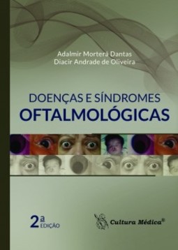 Doenças e síndromes oftalmológicas