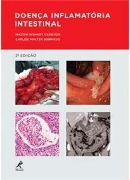 Doença inflamatória intestinal