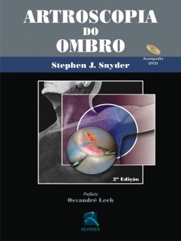 Artroscopia do ombro