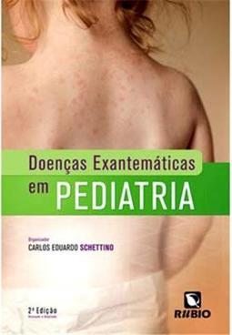 Doenças exantemáticas em pediatria
