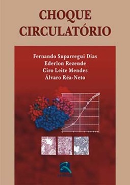 Choque circulatório