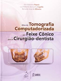 Atlas de tomografia computadorizada por feixe cônico para o cirurgião-dentista