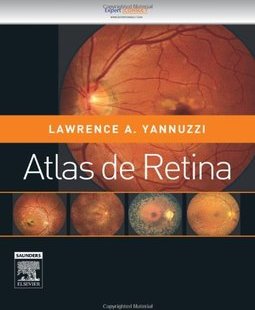 ATLAS DE RETINA