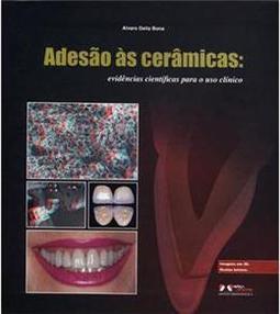 Adesão as Cerâmicas