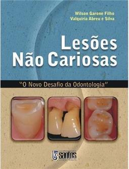 Lesões Não Cariosas