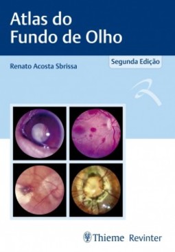 Atlas de fundo de olho